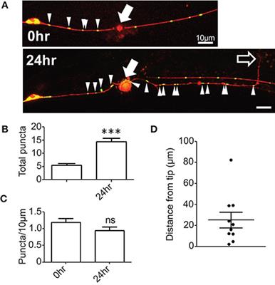A Select Subset of Electron Transport Chain Genes Associated with <mark class="highlighted">Optic Atrophy</mark> Link Mitochondria to Axon Regeneration in Caenorhabditis elegans